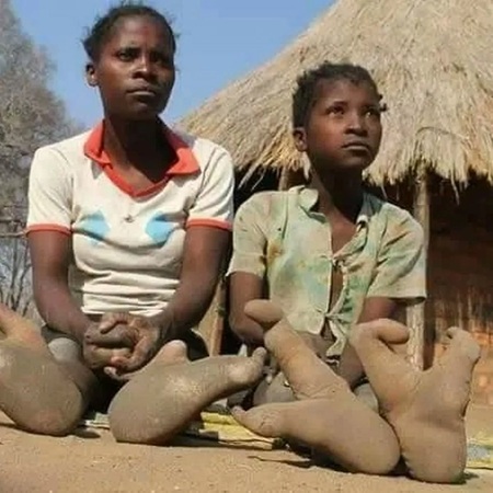 The Vadoma People of Zimbabwe: 7 Unique Facts About Africa’s Tribe with Ostrich-Like Feet